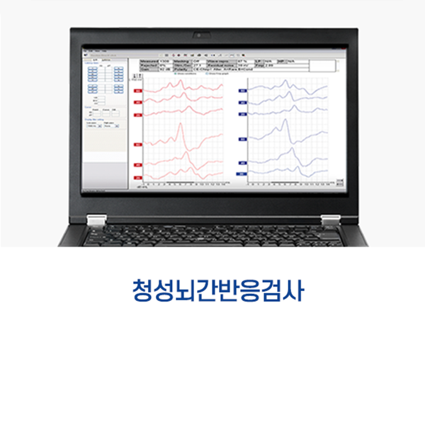 청성뇌간반응검사 — 검사 화면이 뜬 노트북