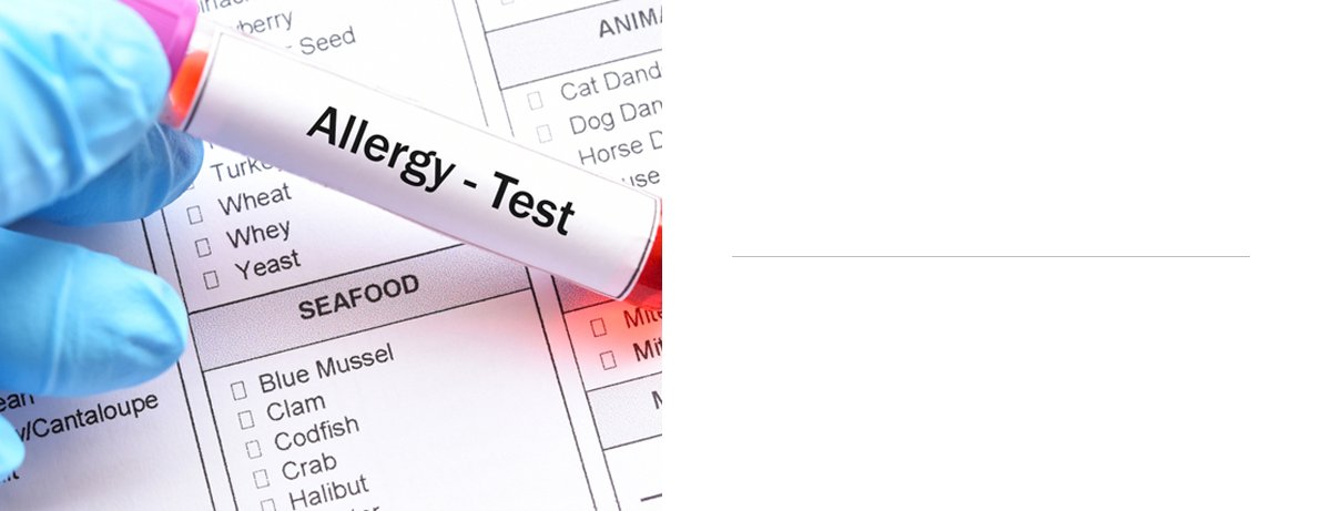 MAST ALLERGY 108종 검사 — 알레르기 검사지와 채혈관