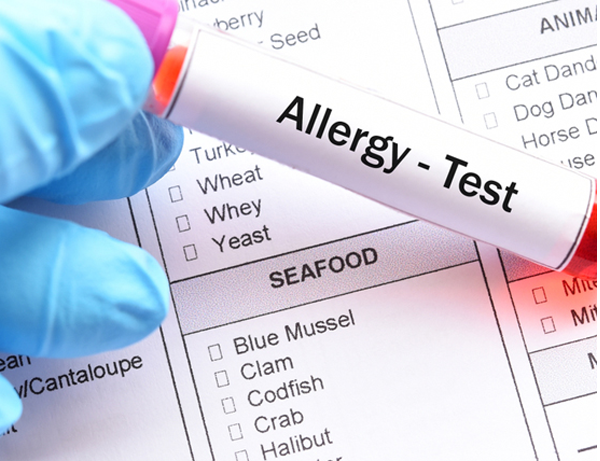 Allergy - Test 라벨이 붙은 채혈관과 알레르기 검사지 사진